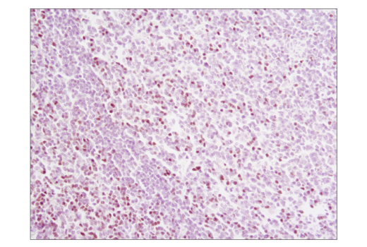 Immunohistochemistry Image 1: TCF1/TCF7 (C63D9) Rabbit Monoclonal Antibody (BSA and Azide Free)