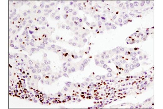 Immunohistochemistry Image 1: Aiolos (D1C1E) Rabbit Monoclonal Antibody (BSA and Azide Free)