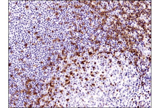 Immunohistochemistry Image 1: CD3 epsilon (D7A6E) Rabbit Monoclonal Antibody