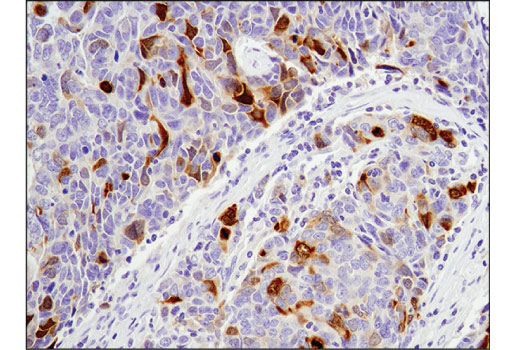 Immunohistochemistry Image 2: Aurora A (D3V7T) Rabbit Monoclonal Antibody (BSA and Azide Free)