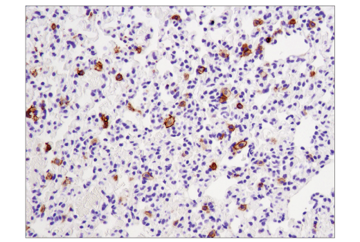 Immunohistochemistry Image 4: CD11c (D1V9Y) Rabbit Monoclonal Antibody (BSA and Azide Free)
