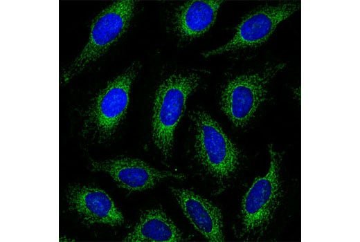 undefined Image 28: Pro-Survival Bcl-2 Family Antibody Sampler Kit II