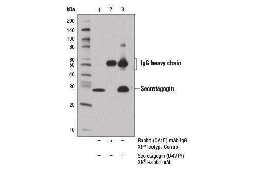 Immunoprecipitation Image 1: Secretagogin (D4V1Y) XP<sup>®</sup> Rabbit mAb