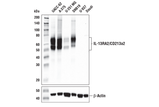 Western Blotting Image 3: IL-13RA2/CD213a2 (E7U7B) Rabbit Monoclonal Antibody (BSA and Azide Free)