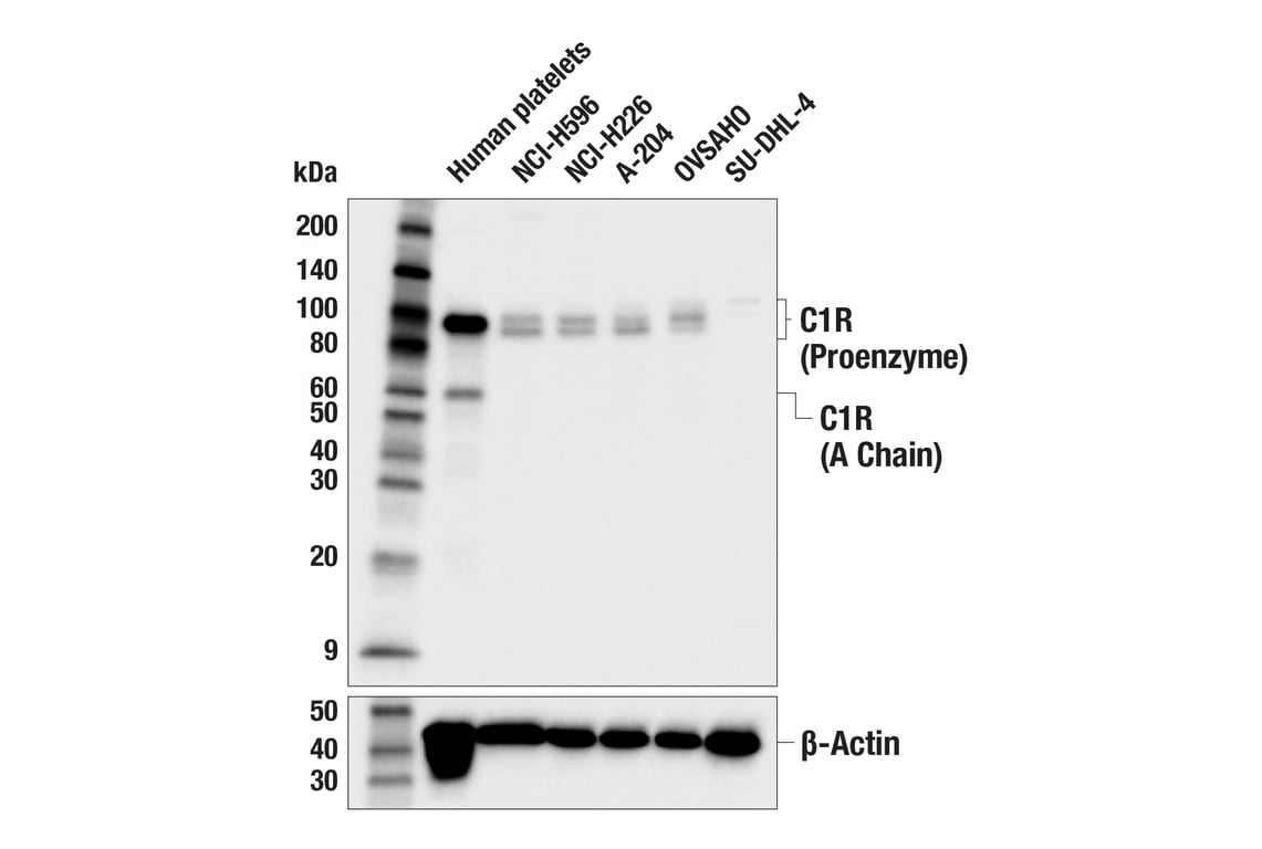 Western Blotting Image 1: C1R (E3R7T) Rabbit mAb