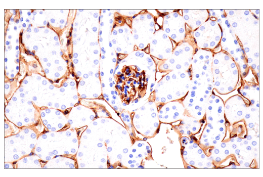 Immunohistochemistry Image 11: CD38 (E9F5A) Rabbit Monoclonal Antibody (BSA and Azide Free)