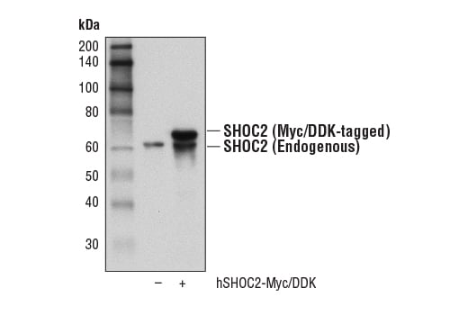 Western Blotting Image 2: SHOC2 (D7N1A) Rabbit Monoclonal Antibody