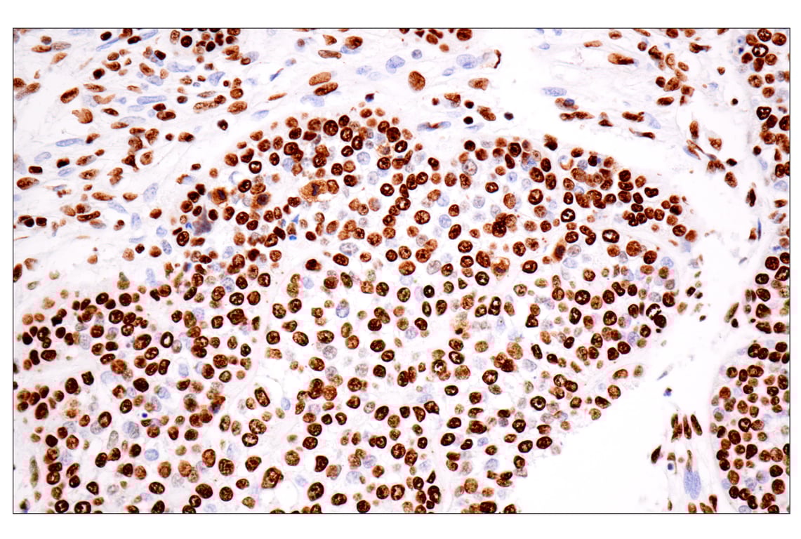 Immunohistochemistry Image 4: ILF3 (E5H6F) Rabbit Monoclonal Antibody