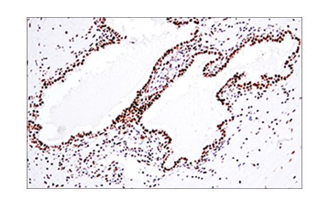 Immunohistochemistry Image 7: 53BP1 (E7N5D) XP<sup>®</sup> Rabbit mAb
