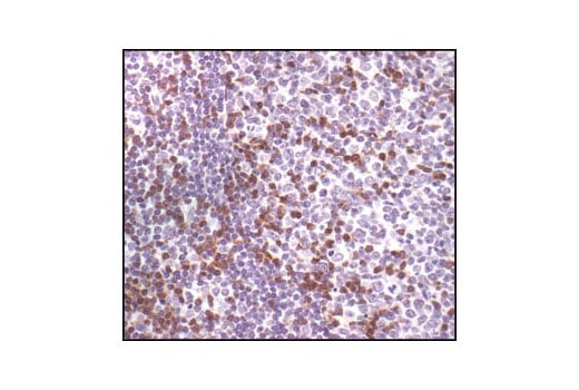 Immunohistochemistry Image 2: Zap-70 (99F2) Rabbit Monoclonal Antibody (BSA and Azide Free)