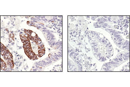 Immunohistochemistry Image 2: Phospho-IKK alpha/beta (Ser176/180) (16A6) Rabbit Monoclonal Antibody (BSA and Azide Free)
