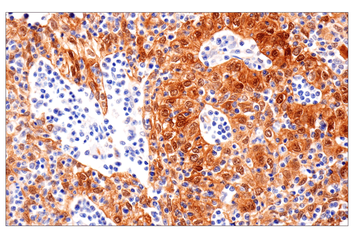 Immunohistochemistry Image 2: HSP27 (E1J4D) Rabbit Monoclonal Antibody