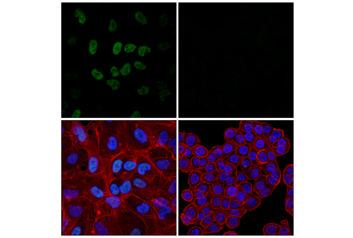 Immunofluorescence Image 1: BORIS (F6R3W) Rabbit Monoclonal Antibody