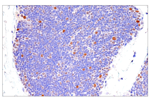 Immunohistochemistry Image 4: PMS2 (M0R4G) Mouse Monoclonal Antibody