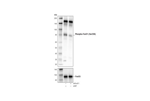 Western Blotting Image 3: Phospho-FoxO1 (Ser256) (E1F7T) Rabbit Monoclonal Antibody