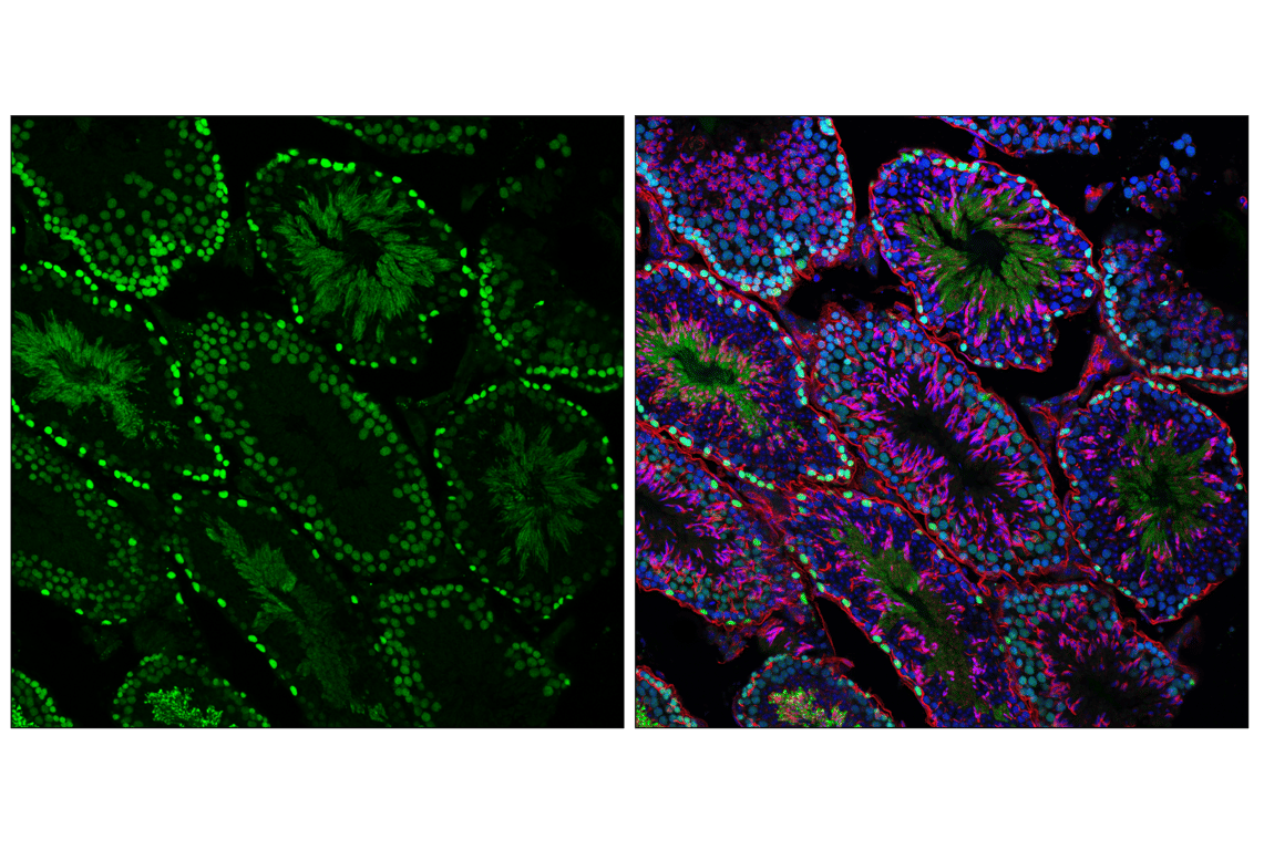 Phospho-Rb (Ser807/811) (D20B12) XP® Rabbit mAb | Cell