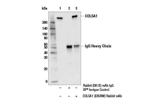 Immunoprecipitation Image 1: COL5A1 (E6U9W) Rabbit Monoclonal Antibody