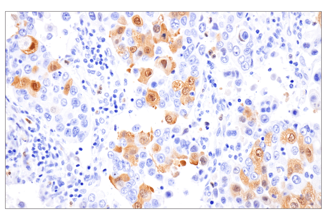 Immunohistochemistry Image 1: Phospho-Stat3 (Ser727) (D4X3C) Rabbit Monoclonal Antibody (BSA and Azide Free)