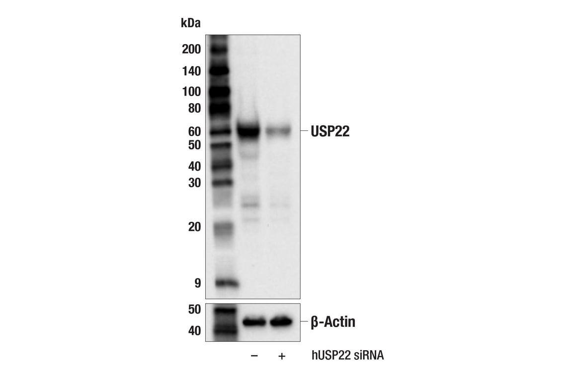 Western Blotting Image 2: USP22 (F4M4V) Rabbit Monoclonal Antibody