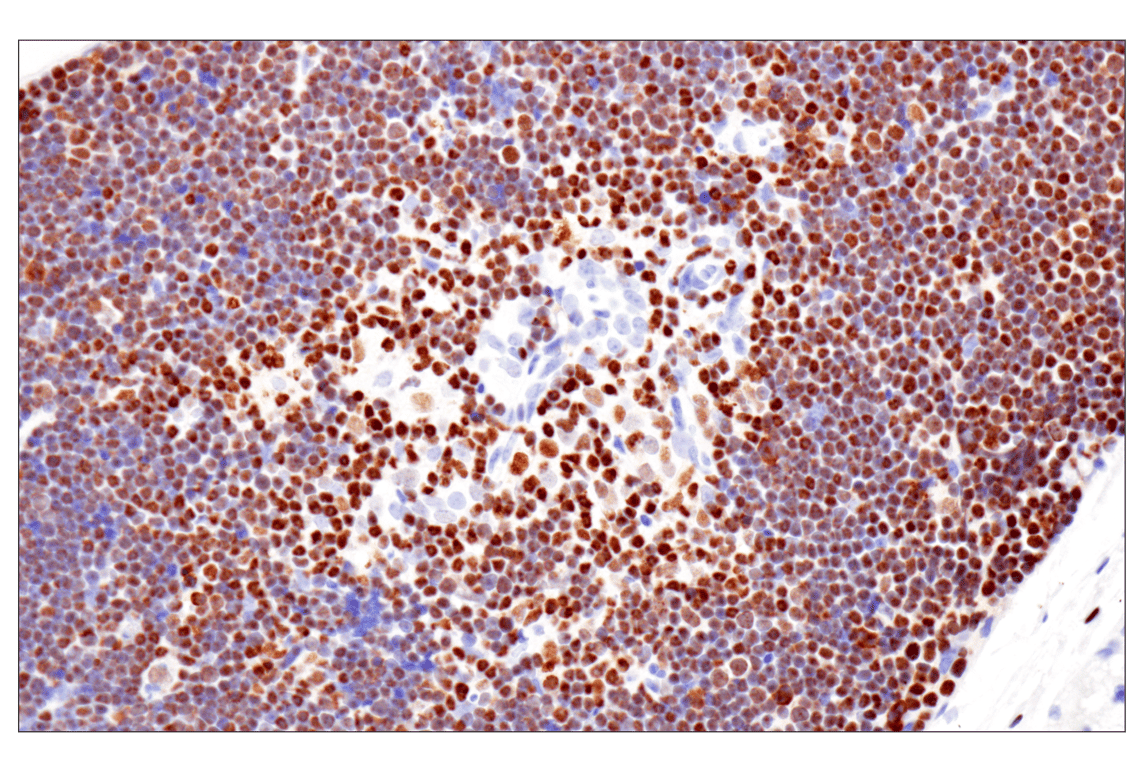 Immunohistochemistry Image 4: Ikaros (D6N9Y) Rabbit Monoclonal Antibody
