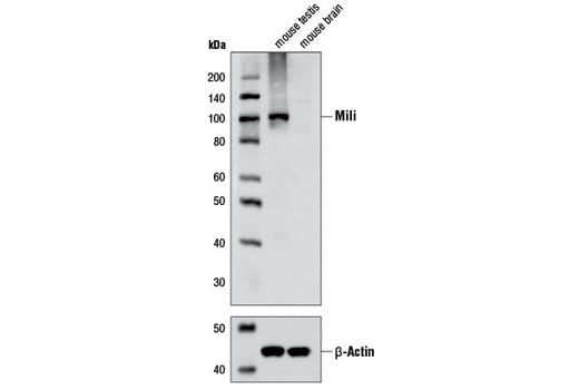 undefined Image 5: RNAi Machinery Antibody Sampler Kit