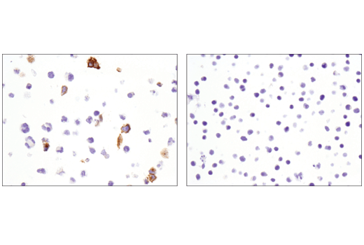 Immunohistochemistry Image 5: OX40 (E9U7O) XP<sup>®</sup> Rabbit mAb