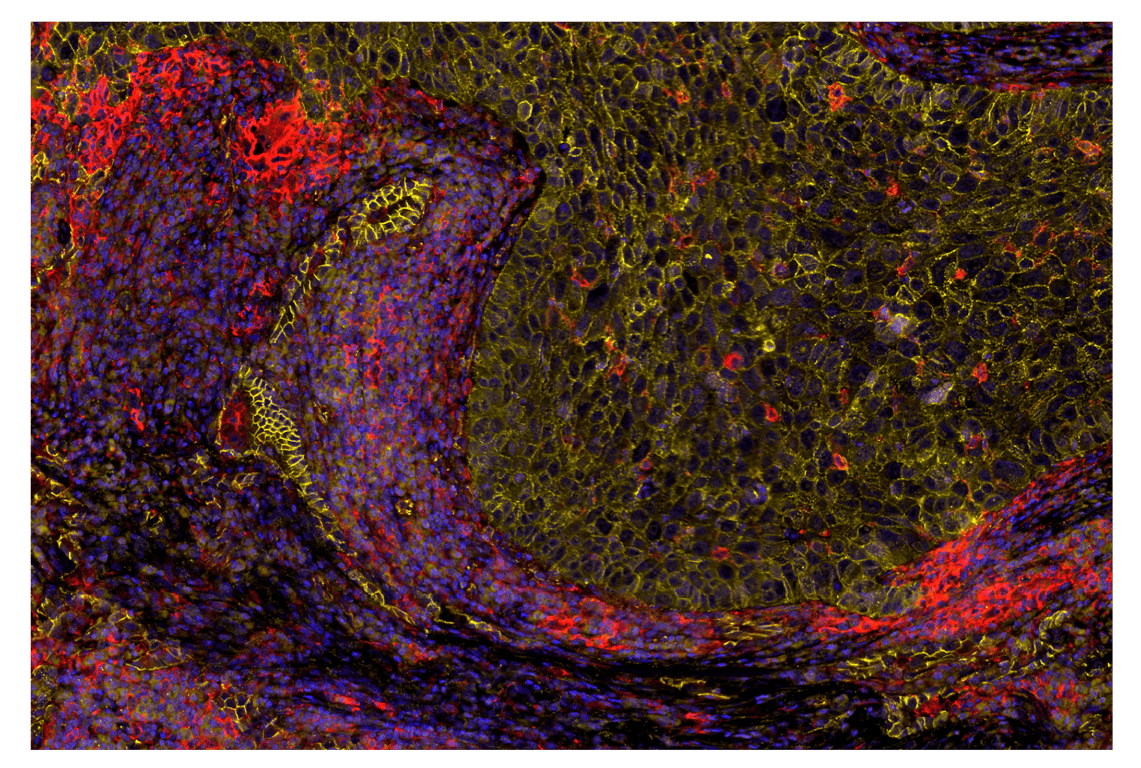 Immunohistochemistry Image 2: beta-Catenin (D10A8) & CO-0108-750 SignalStar<sup>™</sup> Oligo-Antibody Pair