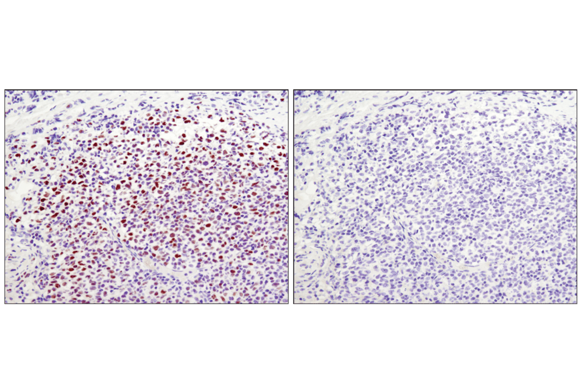 Immunohistochemistry Image 1: Tri-Methyl-Histone H3 (Lys27) (C36B11) Rabbit Monoclonal Antibody