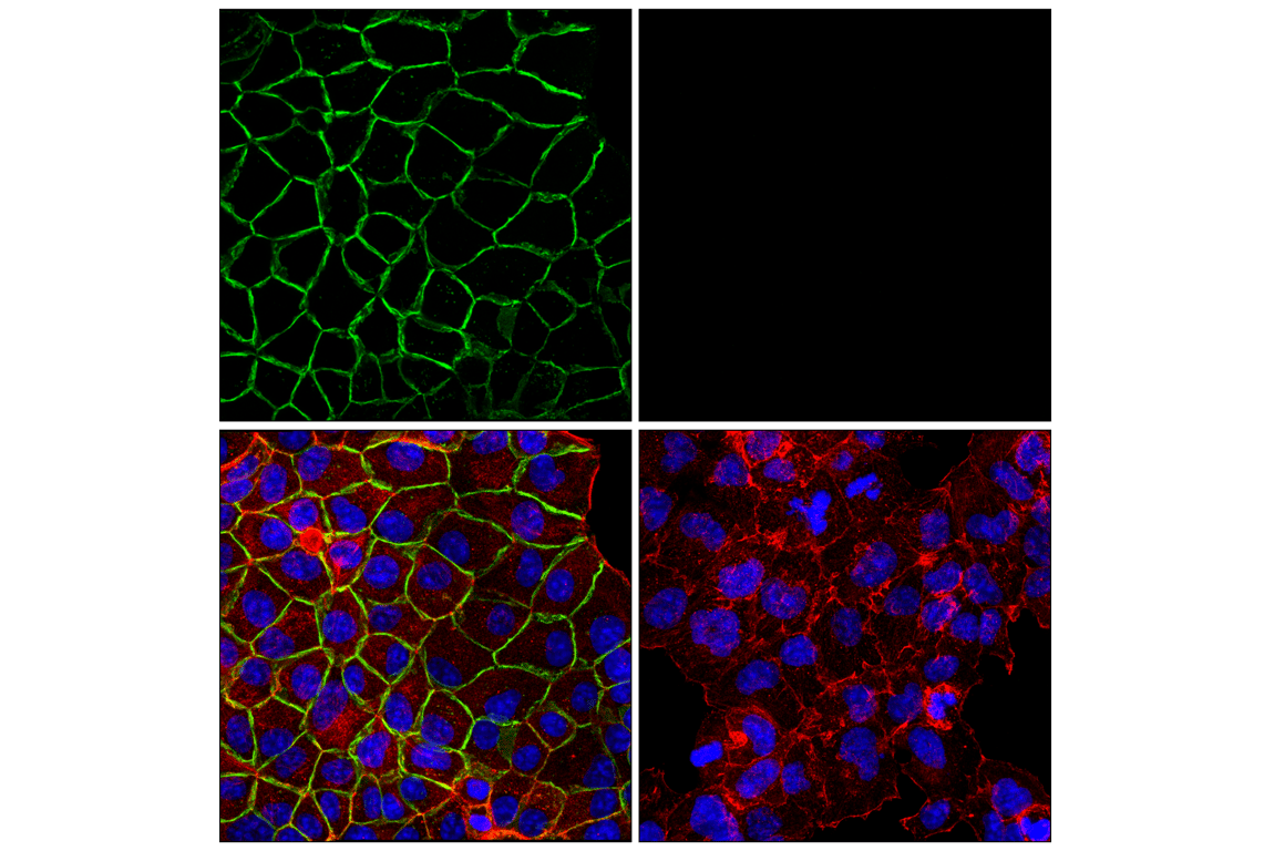 Immunofluorescence Image 1: ALCAM (F3V8Q) Rabbit Monoclonal Antibody