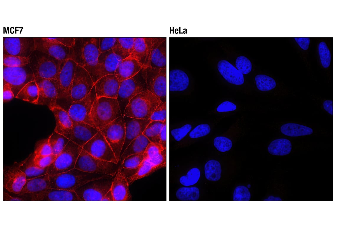 Immunofluorescence Image 1: E-Cadherin (24E10) Rabbit Monoclonal Antibody (Alexa Fluor<sup>®</sup> 594 Conjugate)