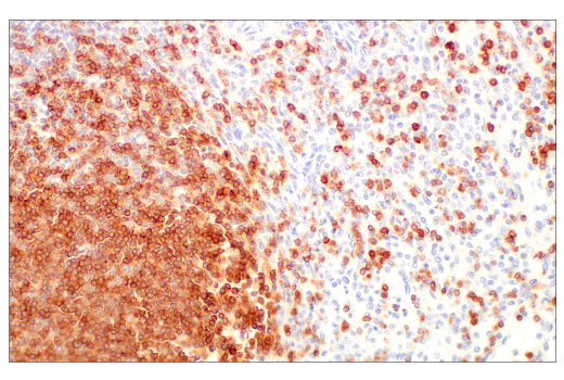 Immunohistochemistry Image 3: CD3 epsilon (D7A6E) Rabbit Monoclonal Antibody (BSA and Azide Free)