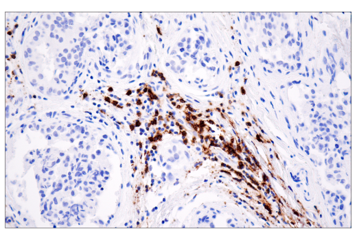 Immunohistochemistry Image 2: CD20 (E7B7T) Rabbit Monoclonal Antibody (BSA and Azide Free)