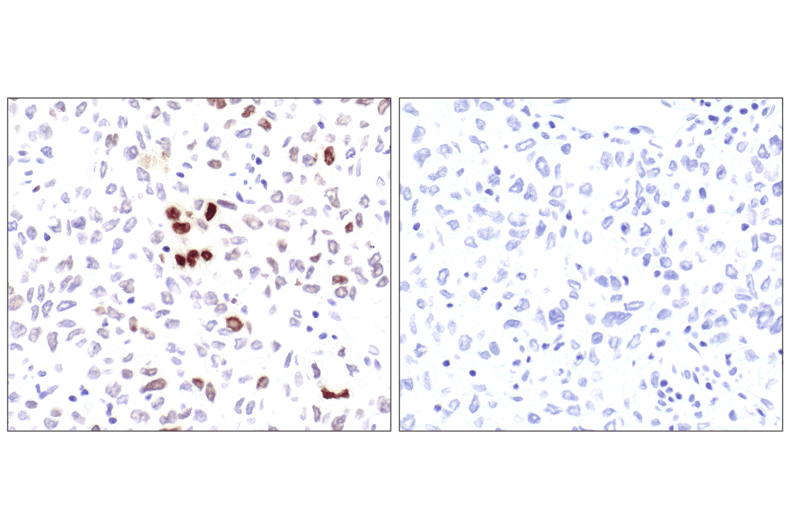 undefined Image 24: DNA Damage Antibody Sampler Kit