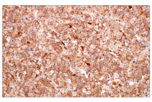 Immunohistochemistry Image 2: SERPINB9 (E9J8J) Rabbit Monoclonal Antibody