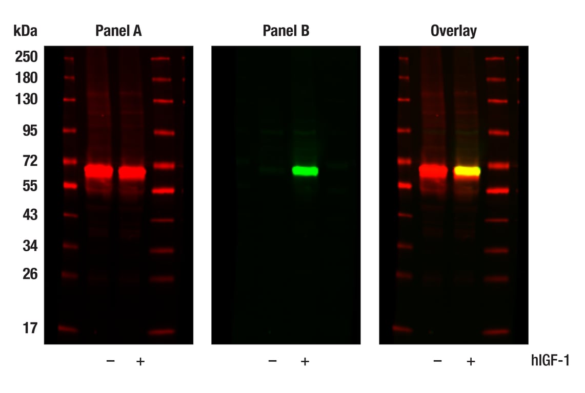Western Blotting Image 1: Akt (pan) (E7J2C) Mouse Monoclonal Antibody