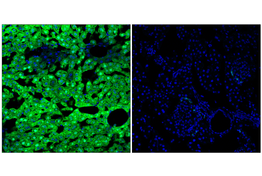 Immunofluorescence Image 2: Arginase-1 (D4E3M<sup>™</sup>) Rabbit Monoclonal Antibody (Alexa Fluor<sup>®</sup> 488 Conjugate)