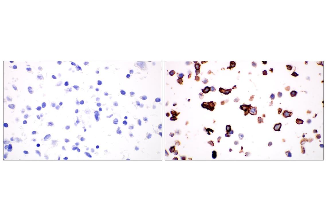 Immunohistochemistry Image 6: LYVE-1 (E5P8S) Rabbit Monoclonal Antibody