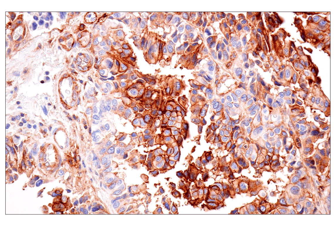 Immunohistochemistry Image 3: HLA-B (BC43) Mouse Monoclonal Antibody