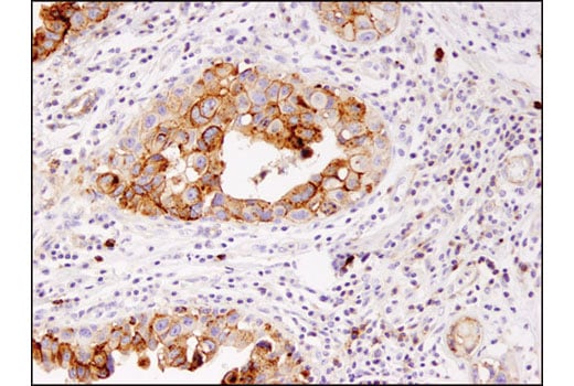 Immunohistochemistry Image 1: CD82 (D7G6H) Rabbit Monoclonal Antibody