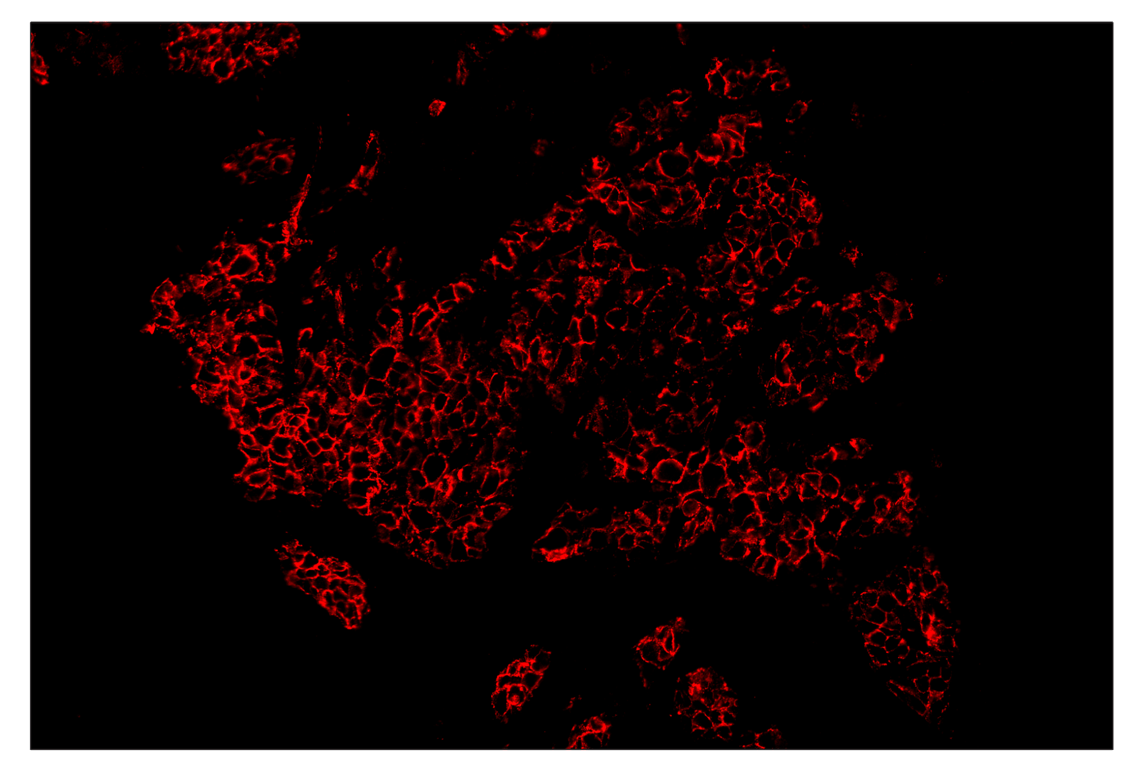 Immunohistochemistry Image 4: E-Cadherin (24E10) & CO-0103-647 SignalStar<sup>™</sup> Oligo-Antibody Pair