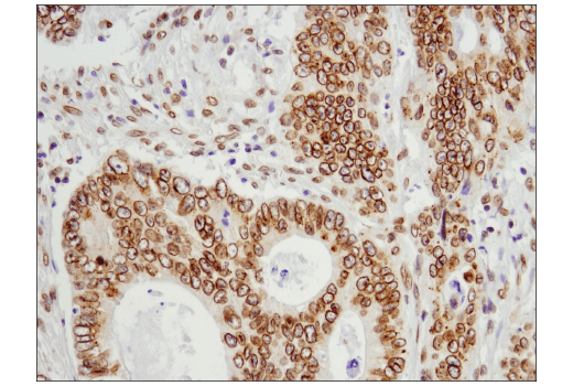 Immunohistochemistry Image 1: Exportin-1/CRM1 (D6V7N) Rabbit Monoclonal Antibody