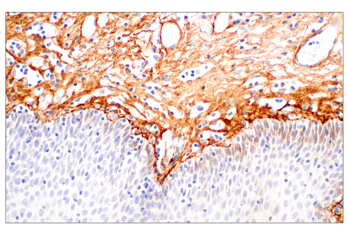Immunohistochemistry Image 8: Tenascin C (E6N4L) Rabbit Monoclonal Antibody