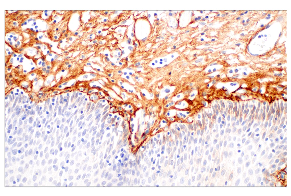 Immunohistochemistry Image 8: Tenascin C (E6N4L) Rabbit mAb