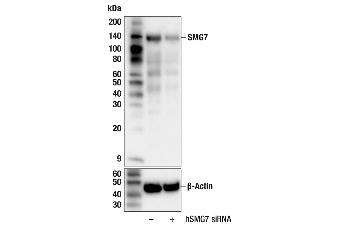 Western Blotting Image 2: SMG7 (F9W1J) Rabbit Monoclonal Antibody