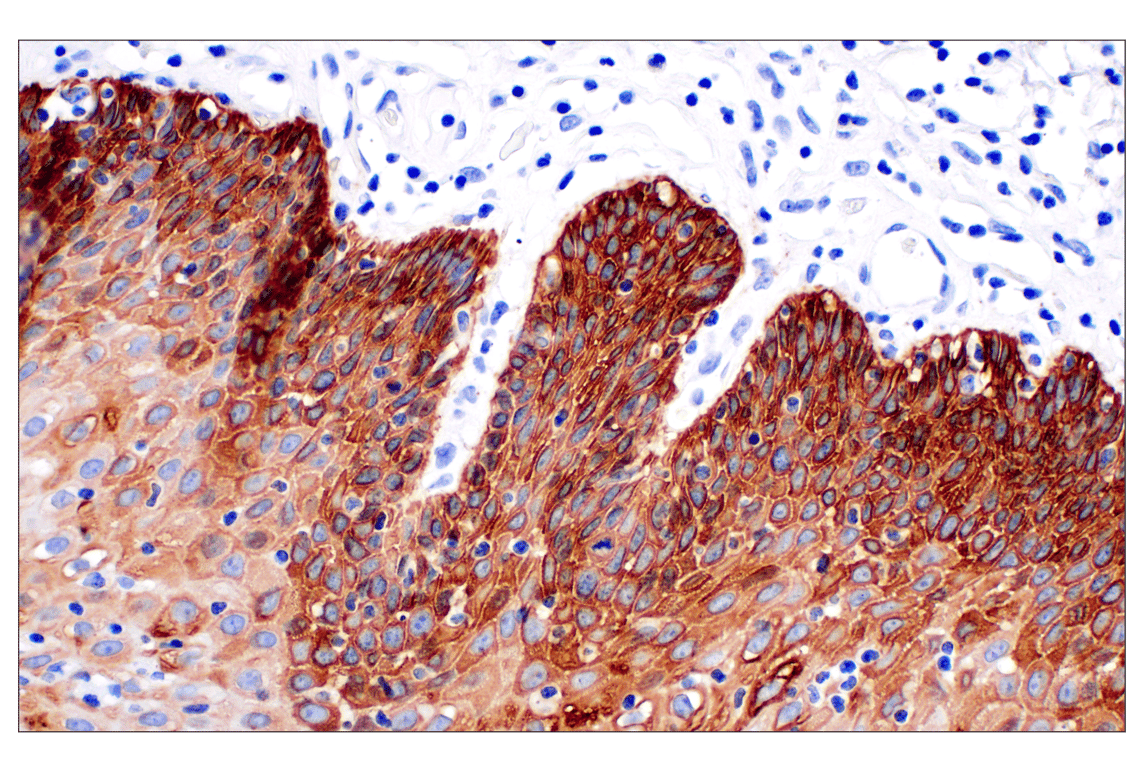 Immunohistochemistry Image 4: Keratin 14 (E7W6V) Rabbit Monoclonal Antibody
