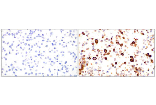 Immunohistochemistry Image 4: SARS-CoV-2 Nucleocapsid Protein (E9L7H) Rabbit Monoclonal Antibody