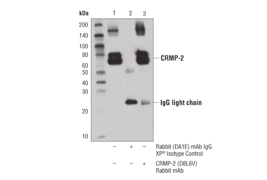 Immunoprecipitation Image 1: CRMP-2 (D8L6V) Rabbit Monoclonal Antibody
