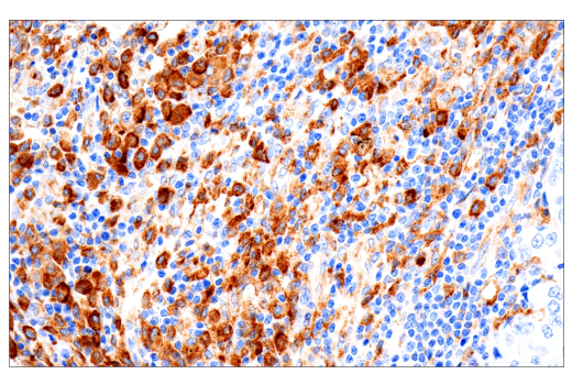 Immunohistochemistry Image 2: FcRn (E9J8W) Rabbit Monoclonal Antibody (BSA and Azide Free)