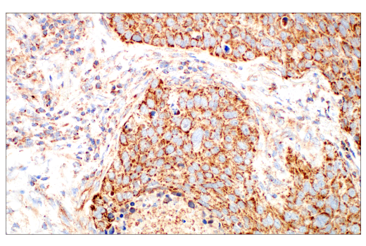 Immunohistochemistry Image 3: TFAM (D5C8) Rabbit Monoclonal Antibody