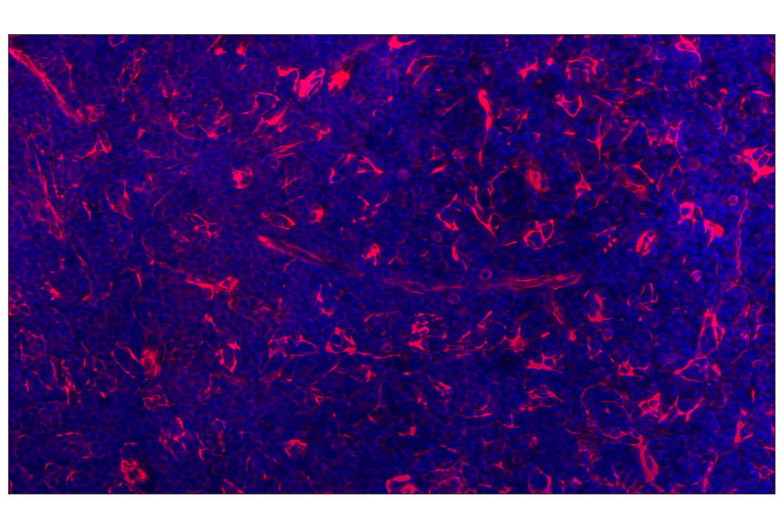 Immunohistochemistry Image 2: Vimentin (D21H3) Rabbit Monoclonal Antibody (Alexa Fluor<sup>®</sup> 647 Conjugate)